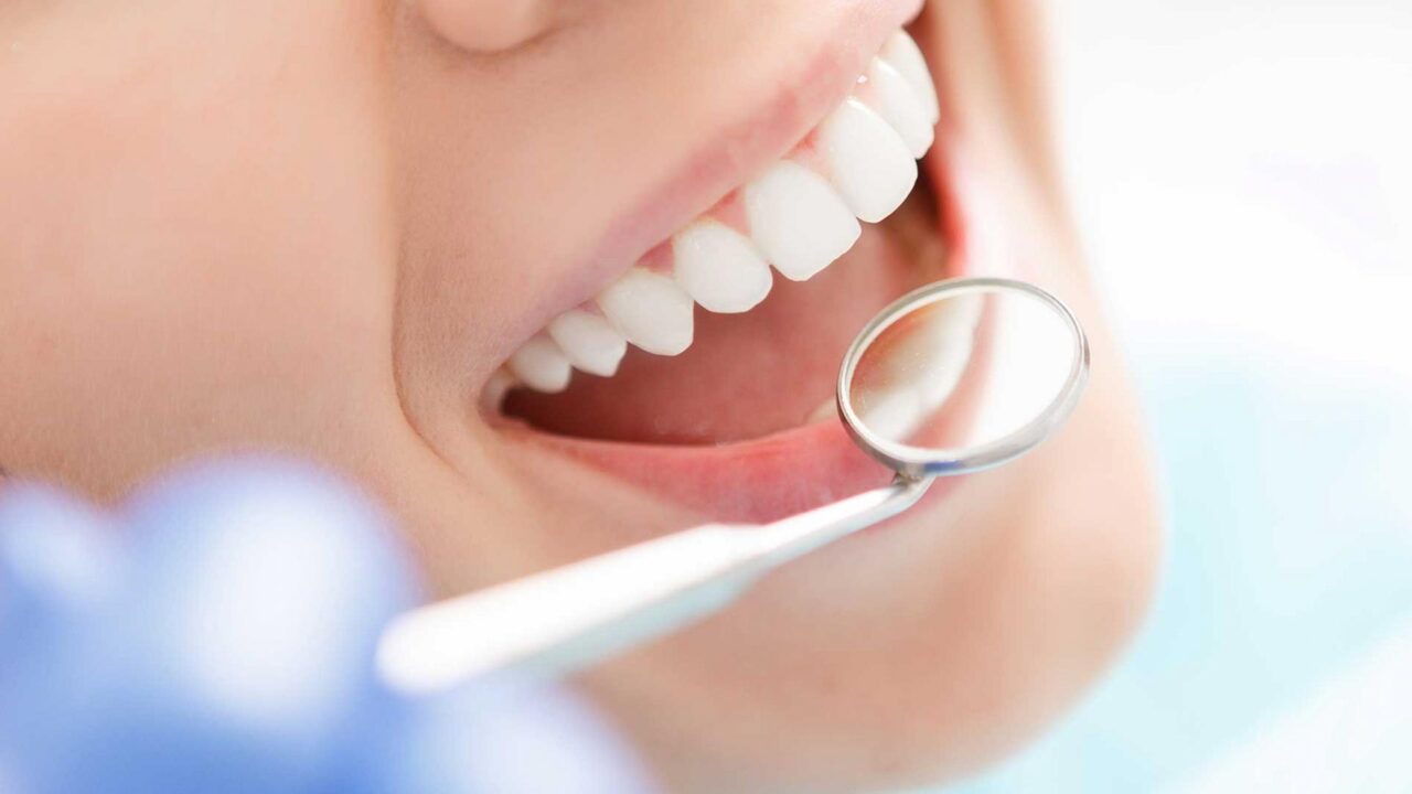 Investing in Your Smile: Securing Long-Term Oral Health with Dental Insurance